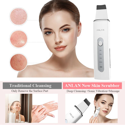 ANLAN Ultrasonic Skin Scrubber